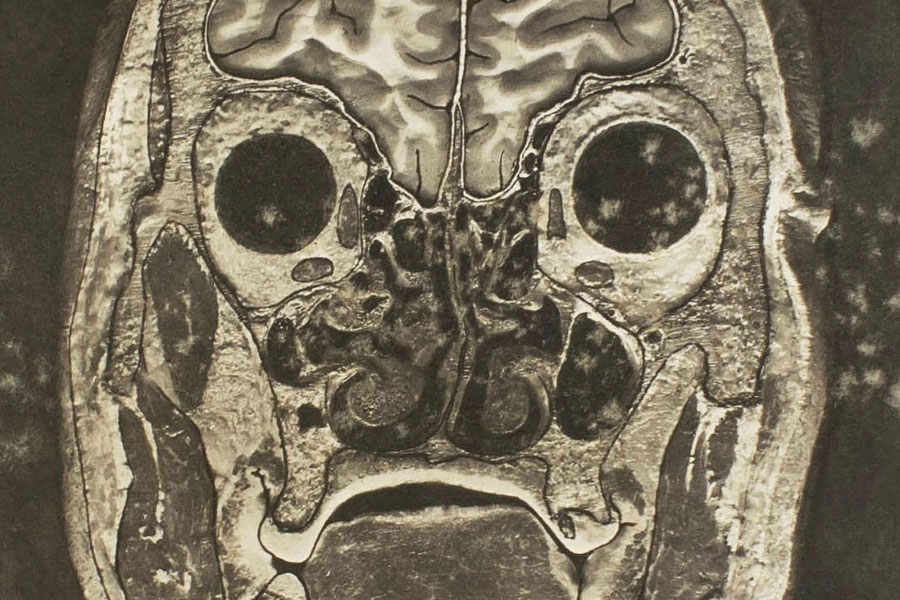 atlas-of-head-sections
