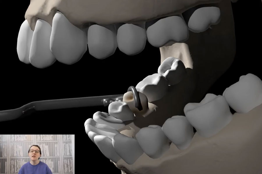 the-dental-key